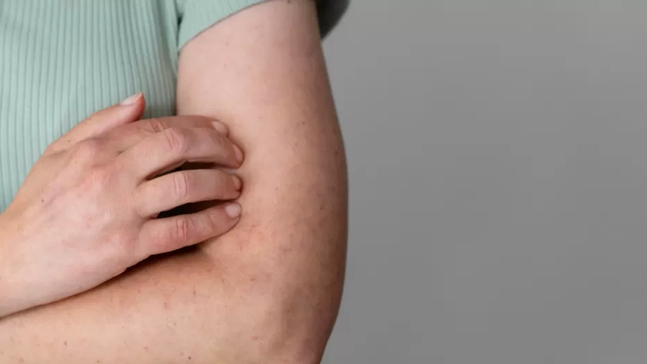 Imagen de Sarampión: el listado completo de vacunatorios disponibles este sábado 6